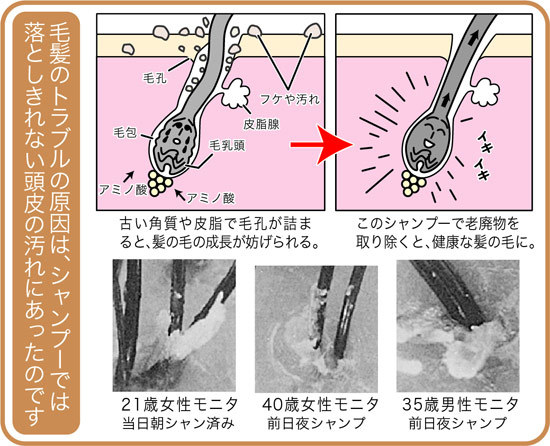 ブラウンシャンプーシリーズ①